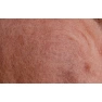 30681-korall-20.png.webp